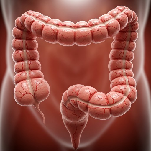 Vastagbél daganat szűrőcsomag